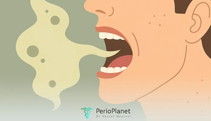 بوی بد دهان چیست و چگونه درمان میشود؟