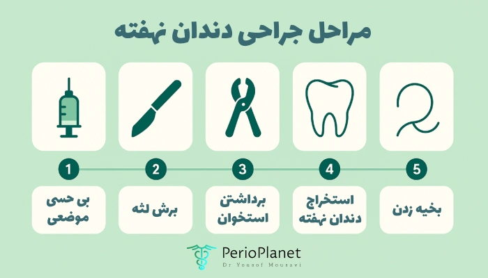 مراحل جراحی دندان نهفته