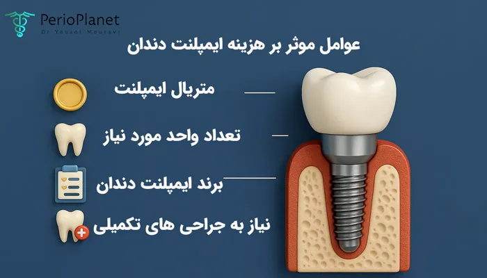 عوامل موثر بر هزینه ایمپلنت دندان در تهران