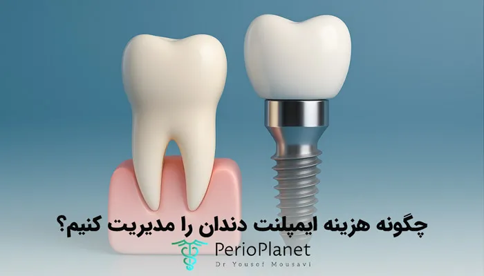 نحوه مدیریت هزینه های ایمپلنت