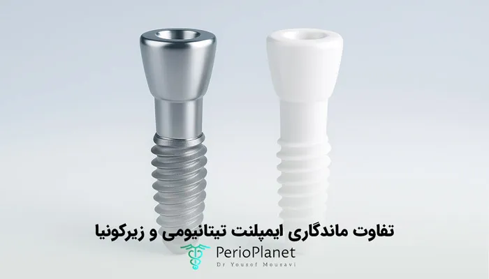 مقایسه ماندگاری ایمپلنت تیتانیومی و زیرکونیا