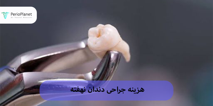 هزینه جراحی دندان نهفته