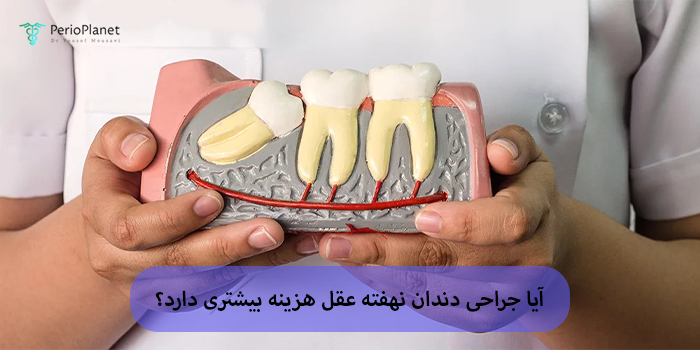 آیا جراحی دندان نهفته عقل هزینه بیشتری دارد؟